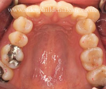 BEFORE treatment