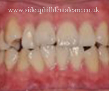 BEFORE treatment