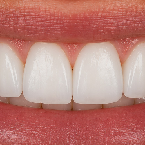 AFTER treatment